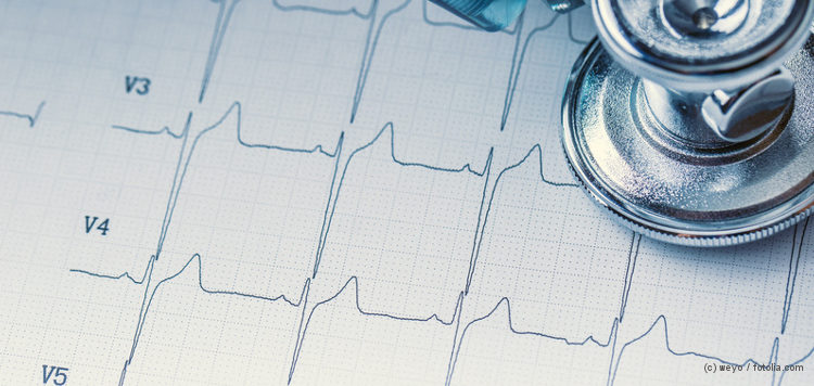 Stethoskop und EKG-Kurve