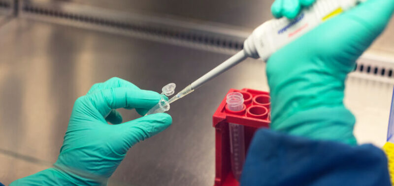 Situation im Labor: Zwei Hände bedienen eine Pipette.