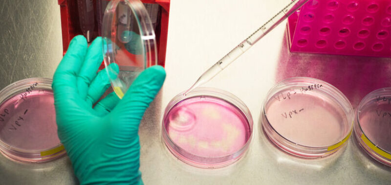 Hand mit Petrischalen und Pipette